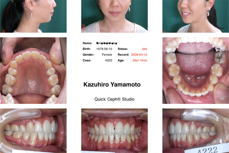 �u�㉺�O�����ɑp���𔺂��������O�ˁE���l�������ȏǗ�̋������Ȑ���ɂ�鋸�����Ȏ��Ì��ʁv